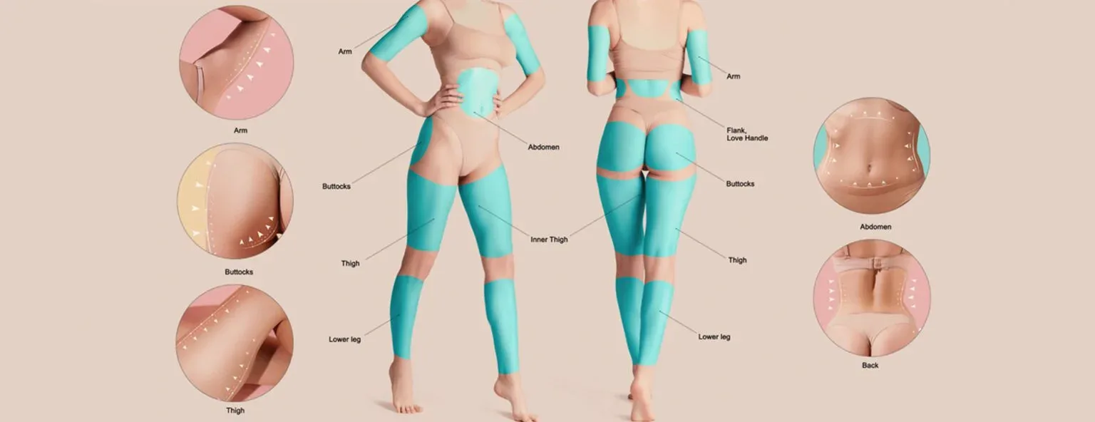 Which Parts of the Body is Suitable for Liposuction?
