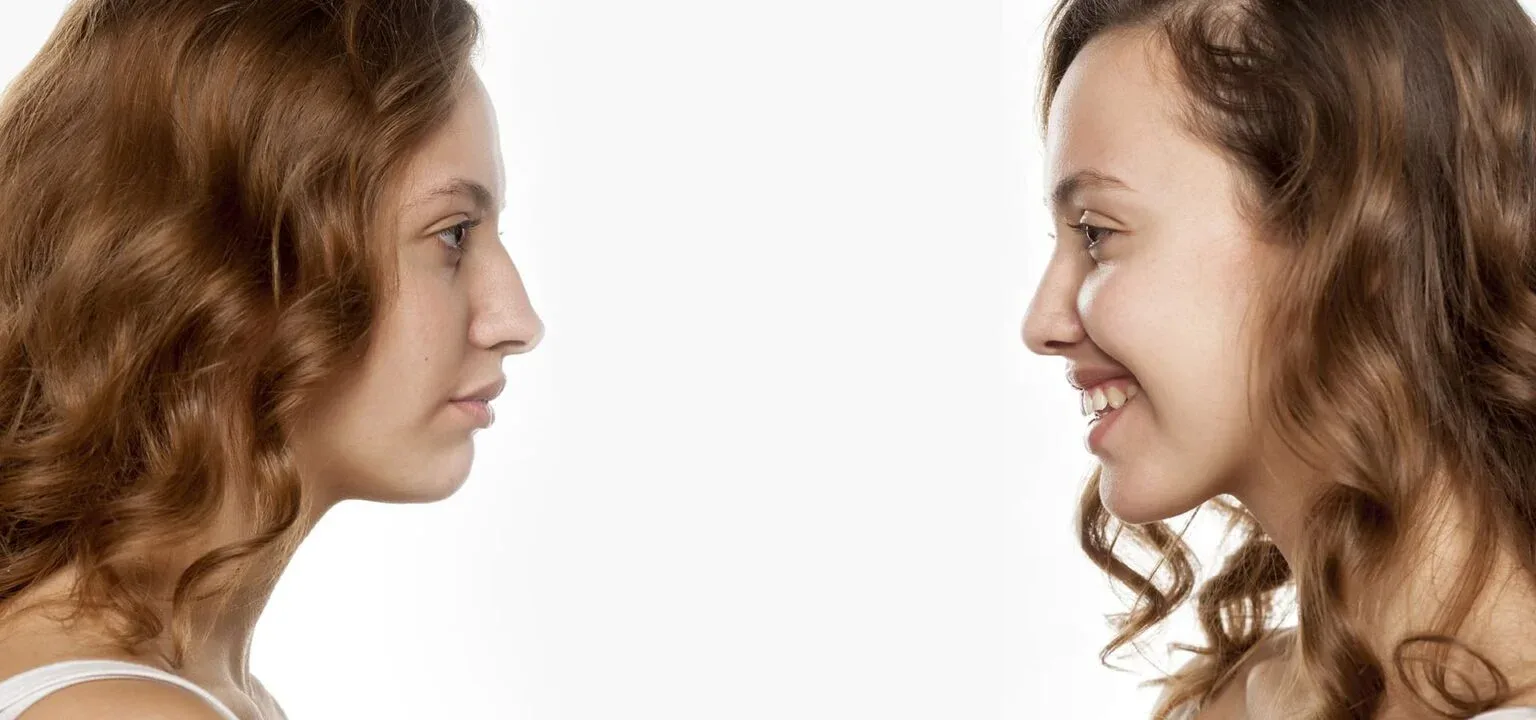 Balance between the chin and nose profile