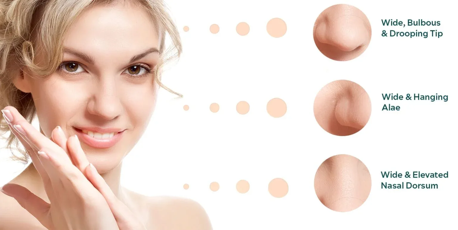 The power of rhinoplasty to refine the nose
