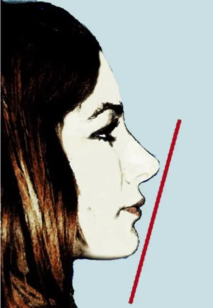 Facial profile showing the balance between nose and chin