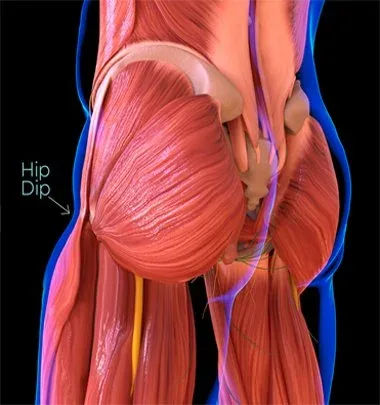 Kalça çukuru (hip dip): kalça ile uyluk arasındaki doğal içe çöküntü